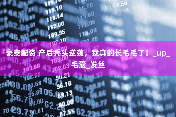 豪泰配资 产后秃头逆袭，我真的长毛毛了！_up_毛囊_发丝